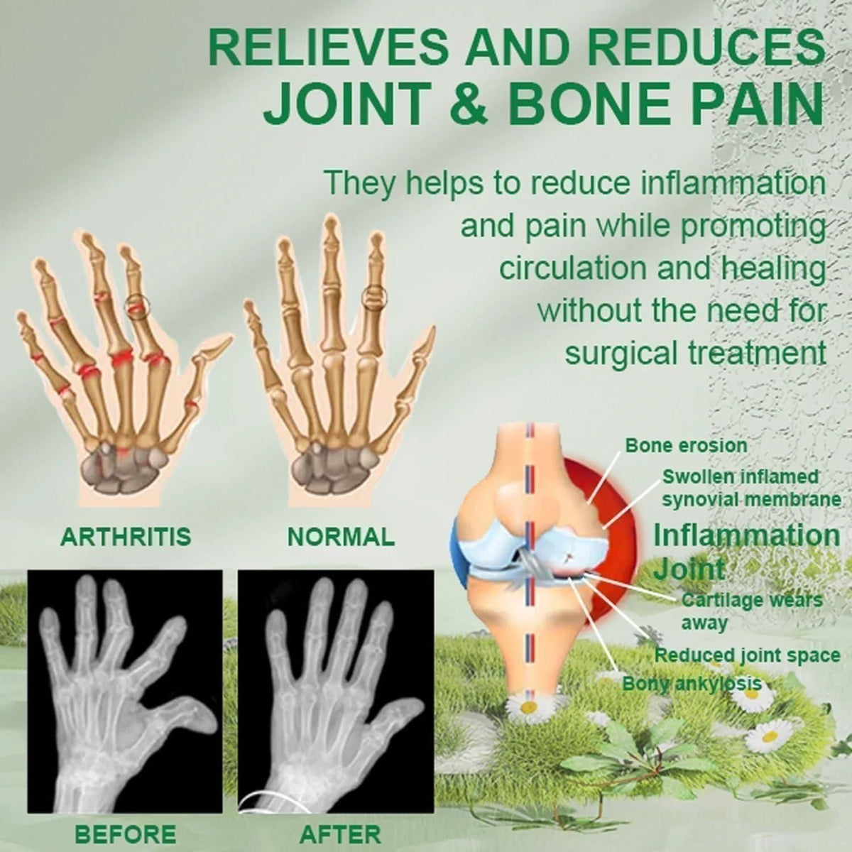 BEE VENOM JOINT AND BONE THERAPY CREAM (PACK OF 3)